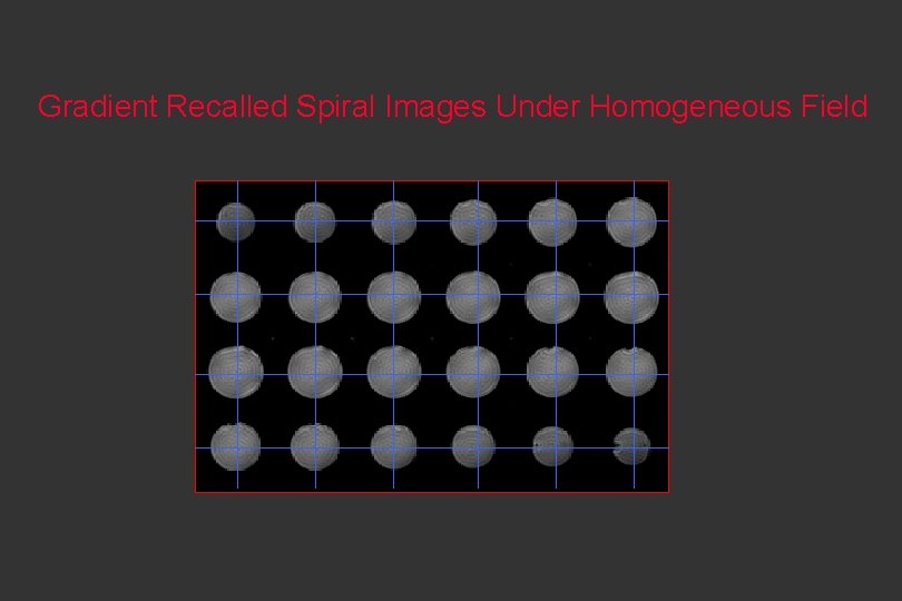 Gradient Recalled Spiral Images Under Homogeneous Field 