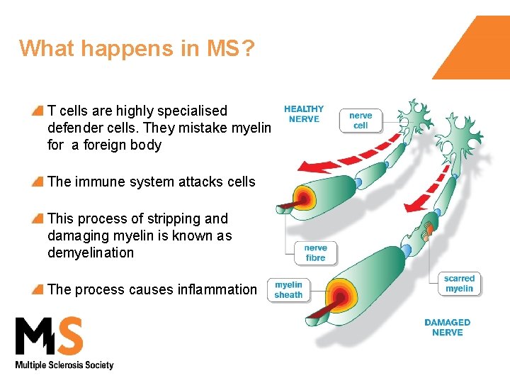 What happens in MS? T cells are highly specialised defender cells. They mistake myelin