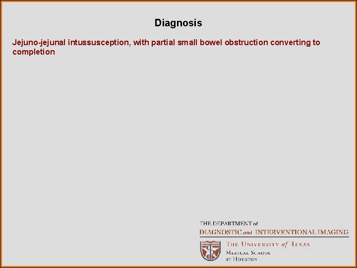 Diagnosis Jejuno-jejunal intussusception, with partial small bowel obstruction converting to completion 