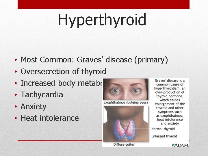 Hyperthyroid • • • Most Common: Graves’ disease (primary) Oversecretion of thyroid Increased body Hyperthyroid • • • Most Common: Graves’ disease (primary) Oversecretion of thyroid Increased body