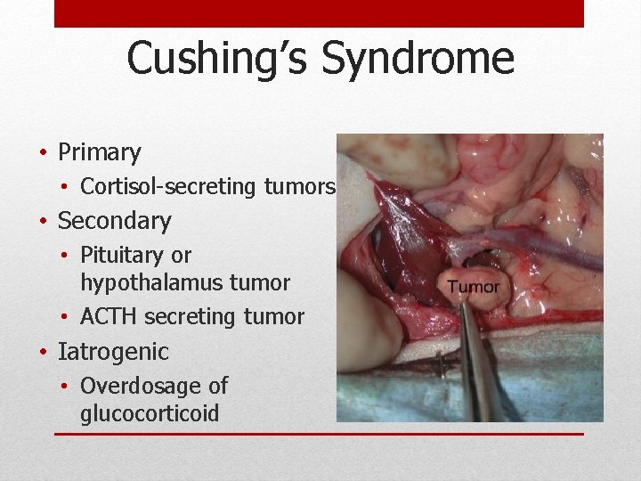 Cushing’s Syndrome • Primary • Cortisol-secreting tumors • Secondary • Pituitary or hypothalamus tumor Cushing’s Syndrome • Primary • Cortisol-secreting tumors • Secondary • Pituitary or hypothalamus tumor