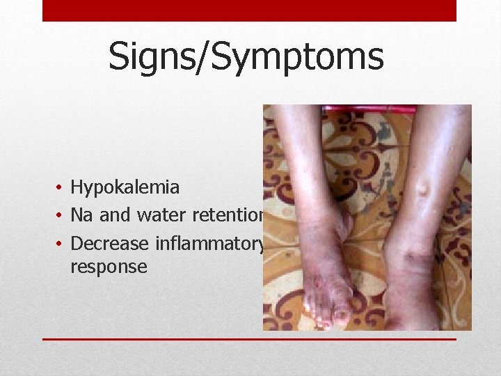 Signs/Symptoms • Hypokalemia • Na and water retention • Decrease inflammatory response Signs/Symptoms • Hypokalemia • Na and water retention • Decrease inflammatory response