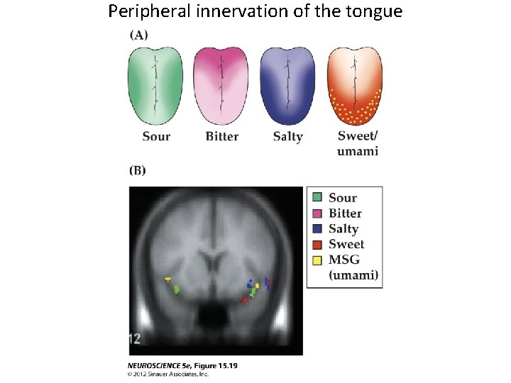 Peripheral innervation of the tongue 