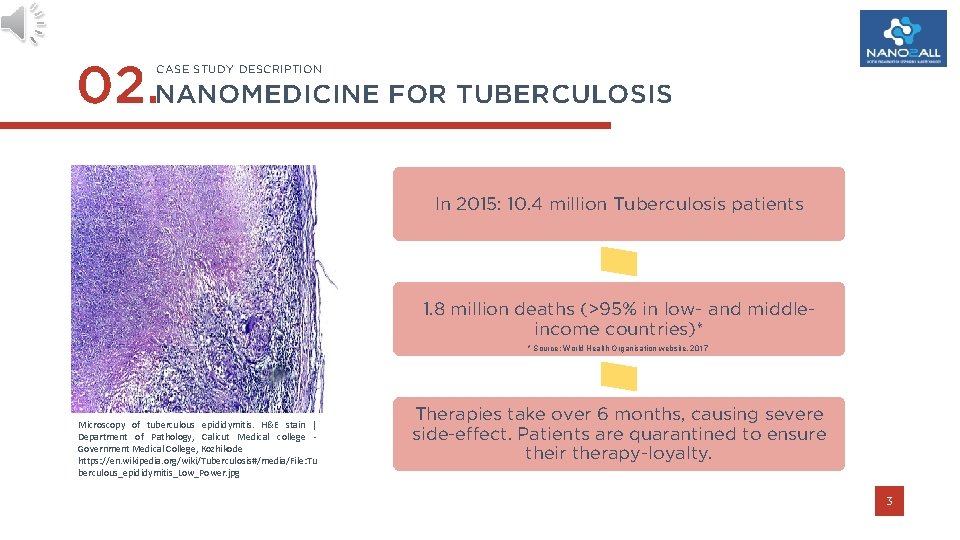 02. NANOMEDICINE FOR TUBERCULOSIS CASE STUDY DESCRIPTION In 2015: 10. 4 million Tuberculosis patients