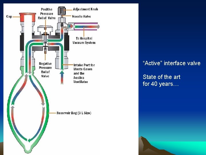 “Active” interface valve State of the art for 40 years… 