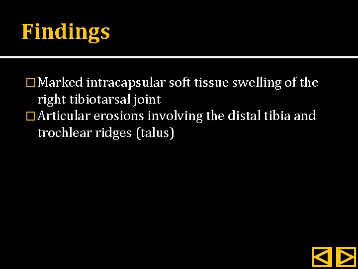 Findings � Marked intracapsular soft tissue swelling of the right tibiotarsal joint � Articular