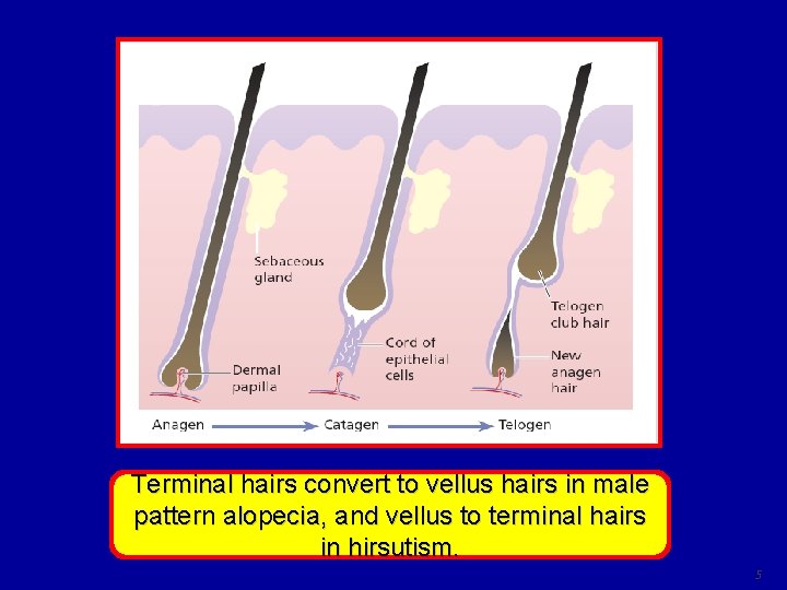 Terminal hairs convert to vellus hairs in male pattern alopecia, and vellus to terminal