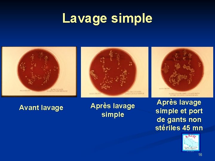 Lavage simple Avant lavage Après lavage simple et port de gants non stériles 45