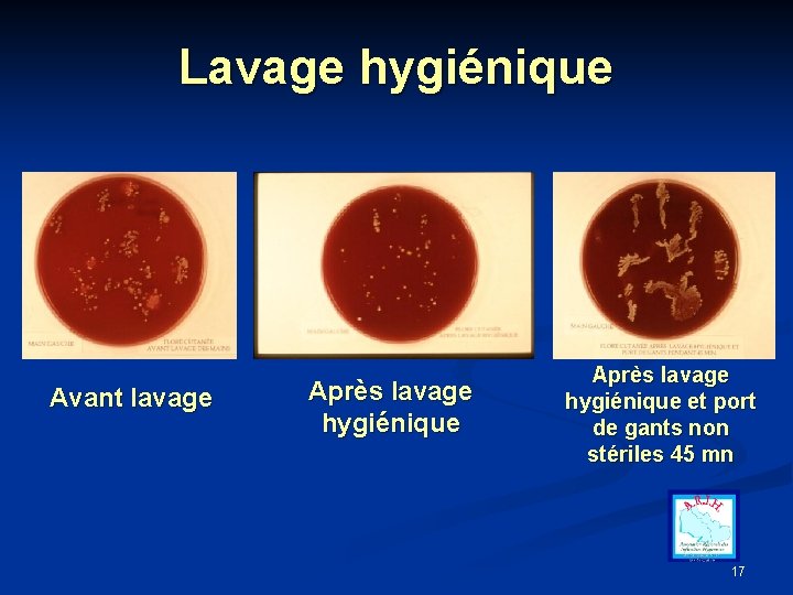 Lavage hygiénique Avant lavage Après lavage hygiénique et port de gants non stériles 45