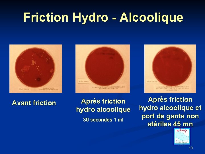 Friction Hydro - Alcoolique Avant friction Après friction hydro alcoolique 30 secondes 1 ml