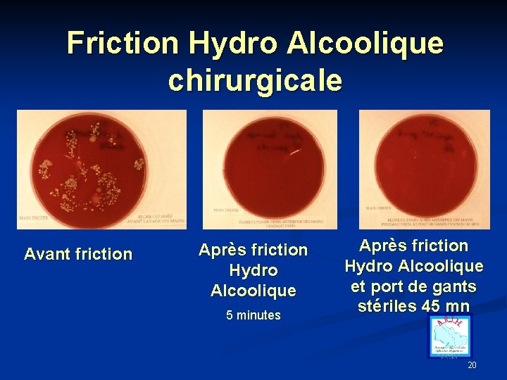 Friction Hydro Alcoolique chirurgicale Avant friction Après friction Hydro Alcoolique 5 minutes Après friction