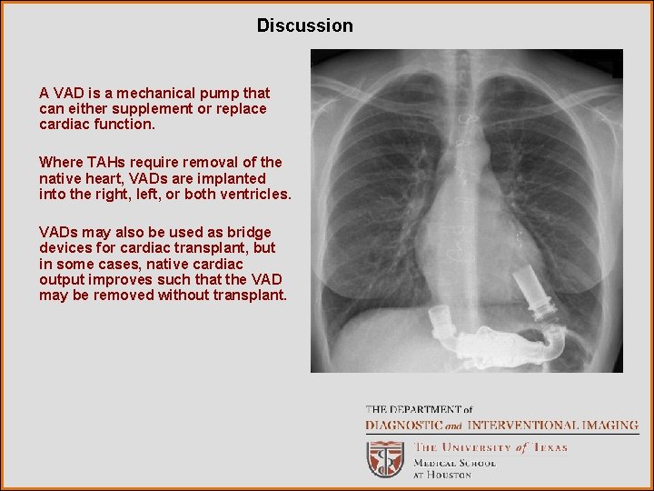 Discussion A VAD is a mechanical pump that can either supplement or replace cardiac