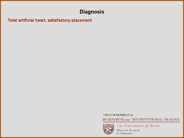 Diagnosis Total artificial heart, satisfactory placement 