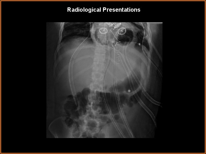 Radiological Presentations 