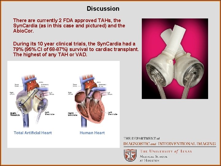Discussion There are currently 2 FDA approved TAHs, the Syn. Cardia (as in this