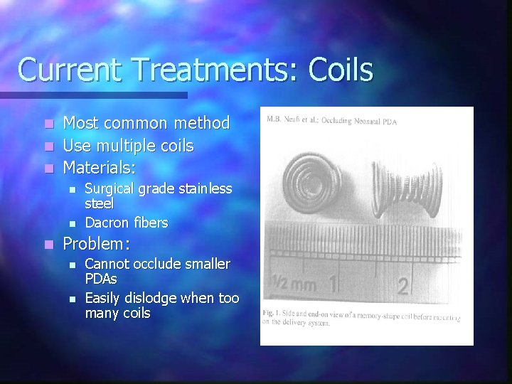 Current Treatments: Coils Most common method n Use multiple coils n Materials: n n
