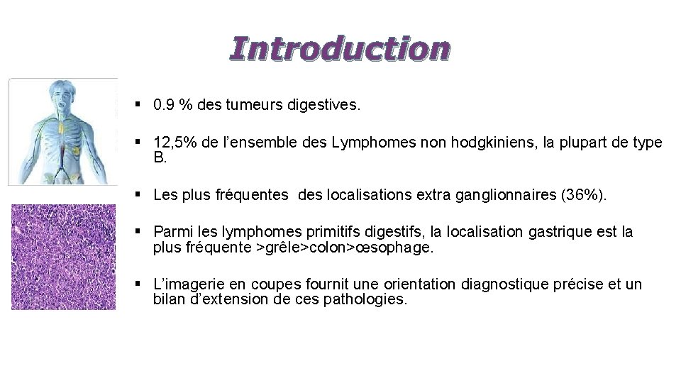 Introduction § 0. 9 % des tumeurs digestives. § 12, 5% de l’ensemble des