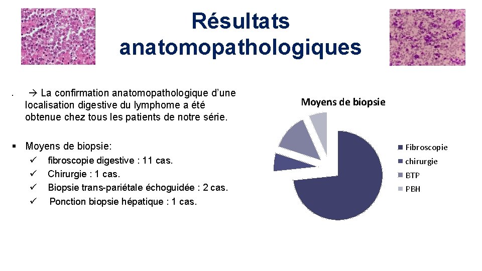 Résultats anatomopathologiques § La confirmation anatomopathologique d’une localisation digestive du lymphome a été obtenue