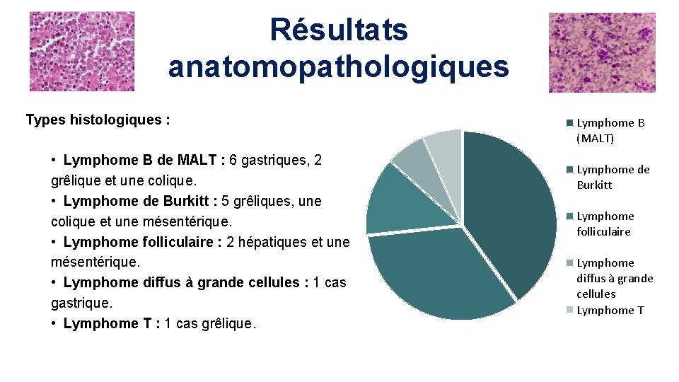 Résultats anatomopathologiques Types histologiques : • Lymphome B de MALT : 6 gastriques, 2