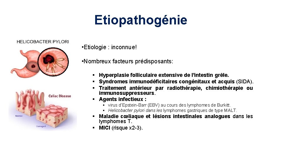 Etiopathogénie • Etiologie : inconnue! • Nombreux facteurs prédisposants: § Hyperplasie folliculaire extensive de