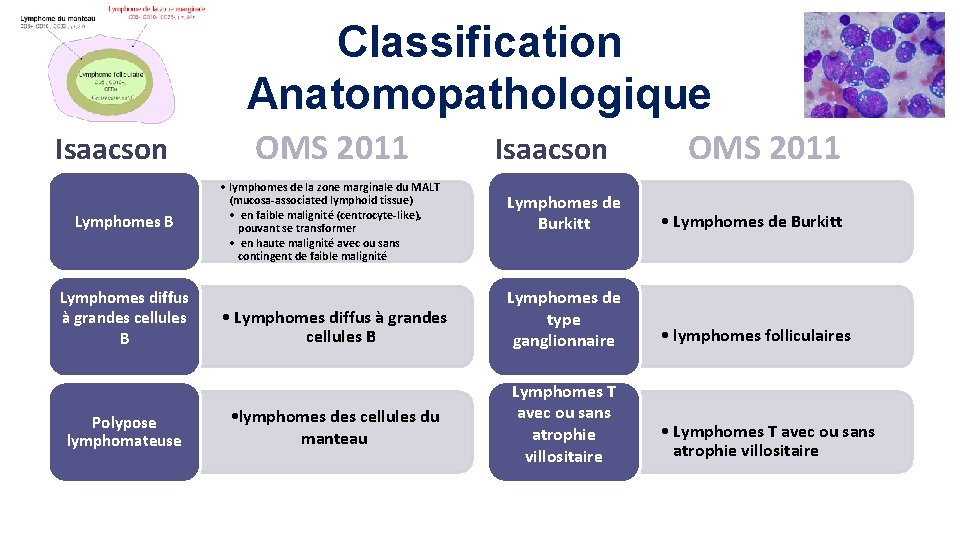 Classification Anatomopathologique Isaacson Lymphomes B Lymphomes diffus à grandes cellules B Polypose lymphomateuse OMS