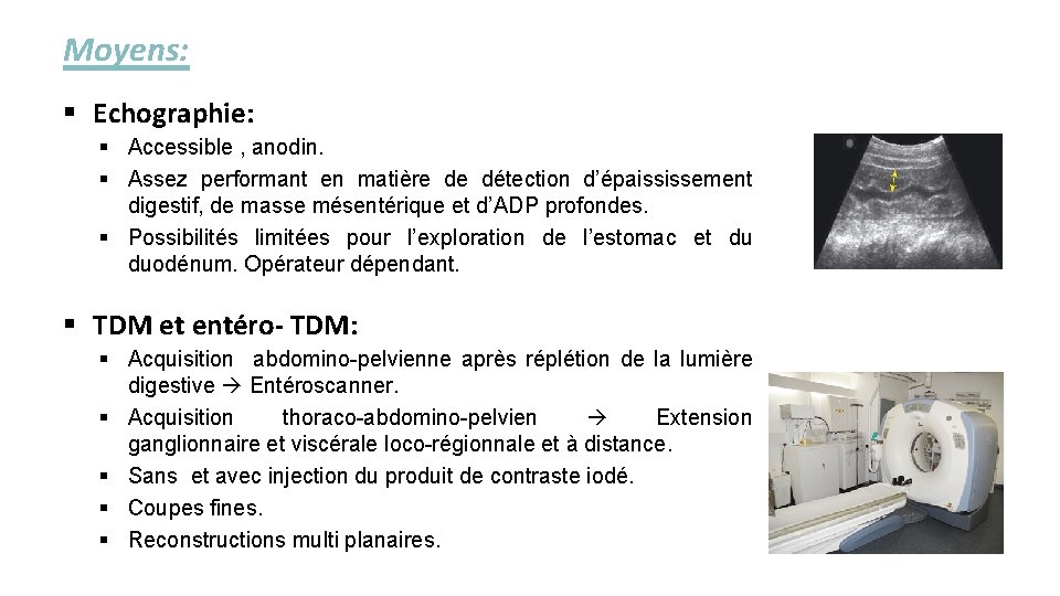 Moyens: § Echographie: § Accessible , anodin. § Assez performant en matière de détection
