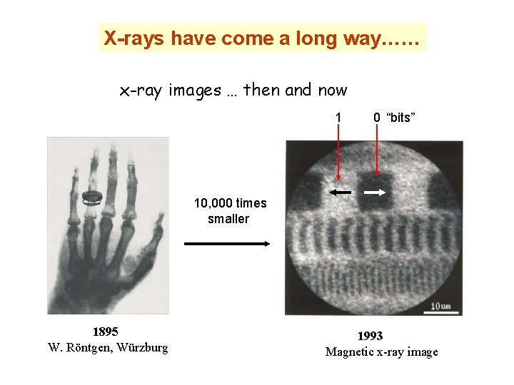 X-rays have come a long way…… x-ray images … then and now 1 0