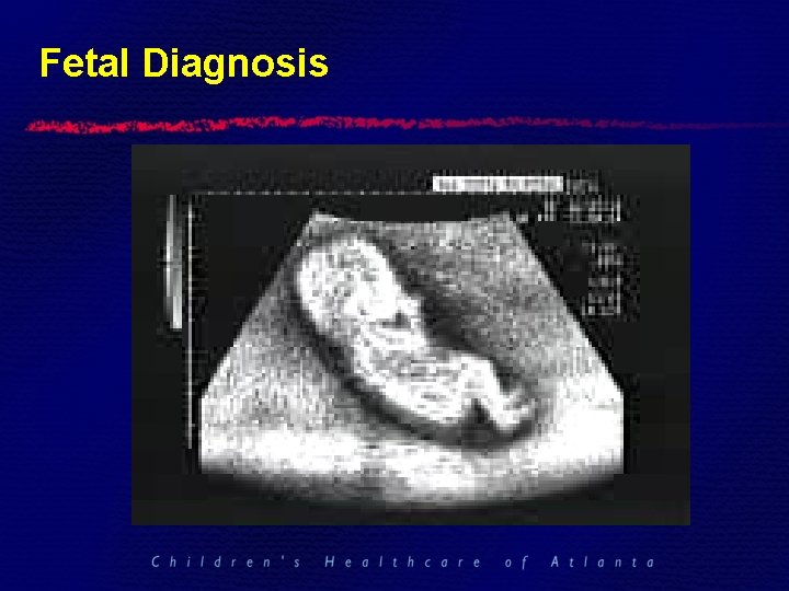 Fetal Diagnosis 