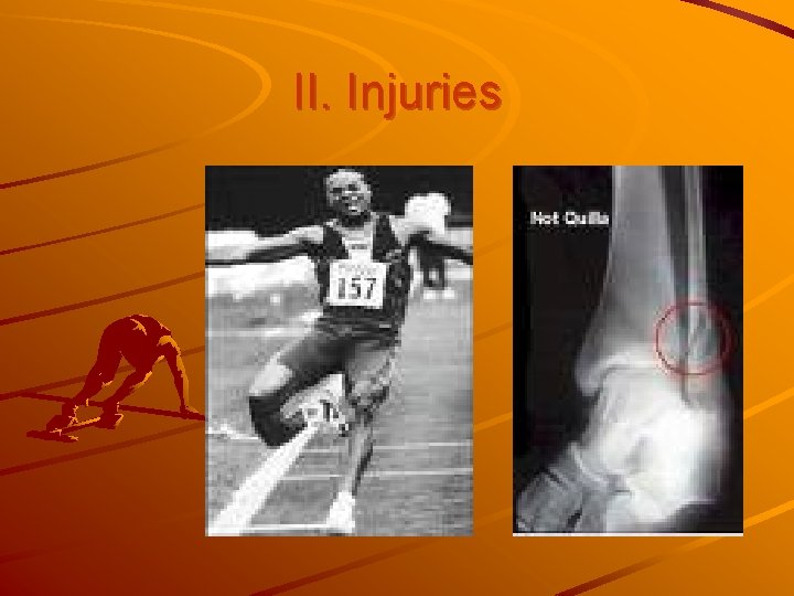 II. Injuries 
