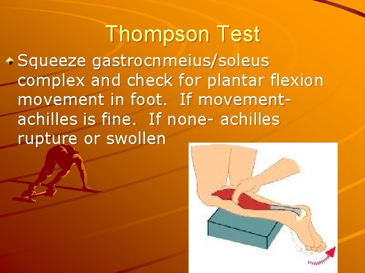 Thompson Test Squeeze gastrocnmeius/soleus complex and check for plantar flexion movement in foot. If