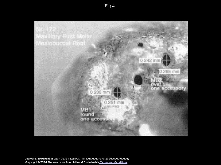 Fig 4 Journal of Endodontics 2004 30321 -328 DOI: (10. 1097/00004770 -200405000 -00005) Copyright
