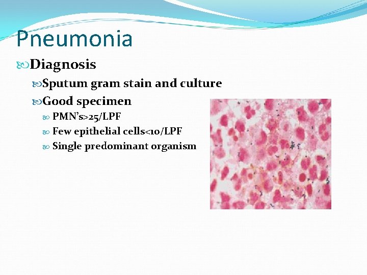 Pneumonia Diagnosis Sputum gram stain and culture Good specimen PMN’s>25/LPF Few epithelial cells<10/LPF Single
