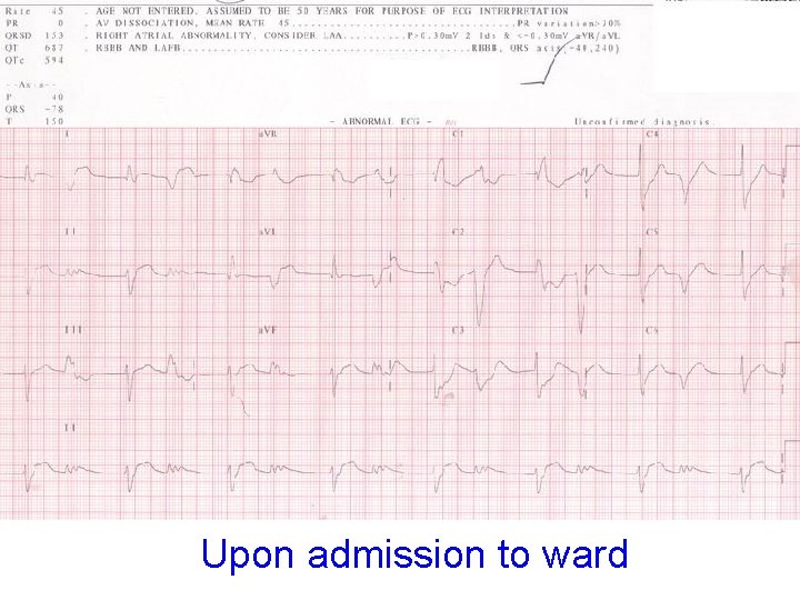 Upon admission to ward 