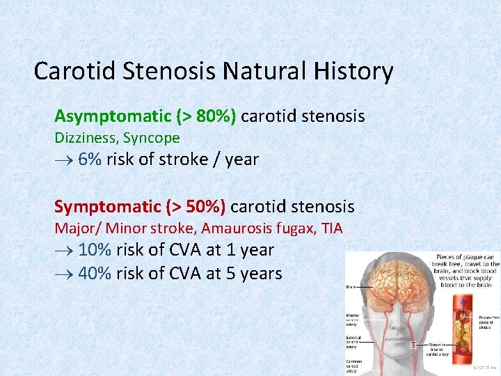 Carotid Stenosis Natural History Asymptomatic (> 80%) carotid stenosis Dizziness, Syncope 6% risk of