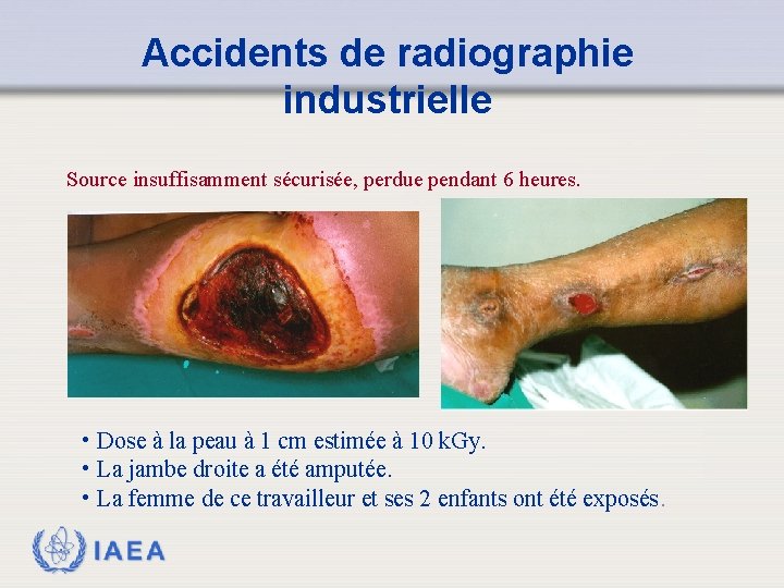 Accidents de radiographie industrielle Source insuffisamment sécurisée, perdue pendant 6 heures. • Dose à