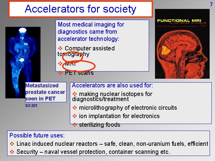 Accelerators for society Most medical imaging for diagnostics came from accelerator technology: v Computer