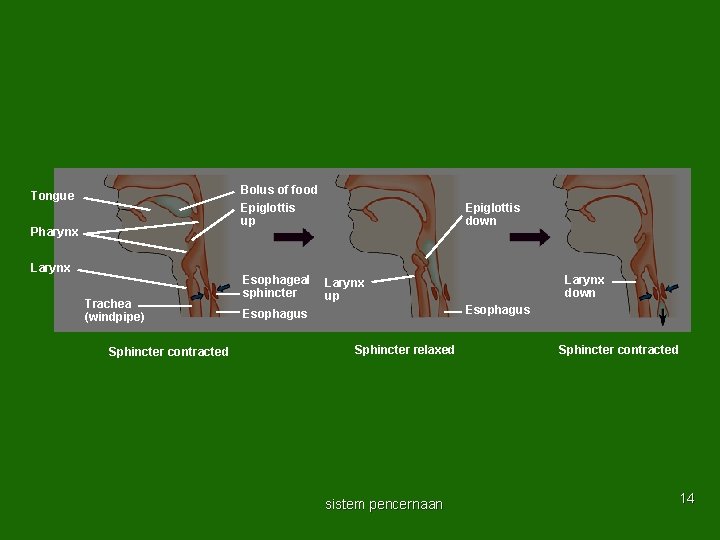 Bolus of food Epiglottis up Tongue Pharynx Larynx Trachea (windpipe) Sphincter contracted Esophageal sphincter