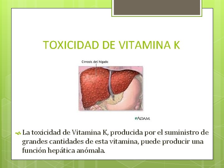 TOXICIDAD DE VITAMINA K La toxicidad de Vitamina K, producida por el suministro de