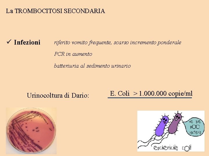 La TROMBOCITOSI SECONDARIA ü Infezioni riferito vomito frequente, scarso incremento ponderale PCR in aumento