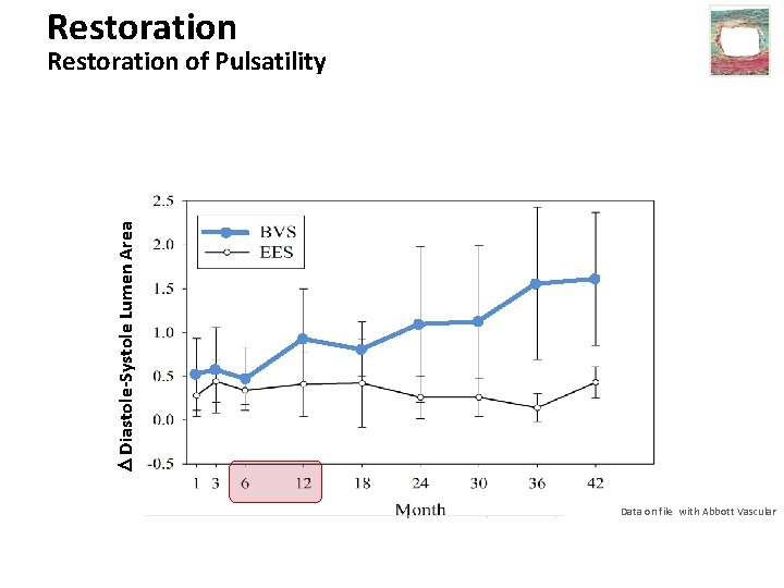 Restoration Diastole-Systole Lumen Area Restoration of Pulsatility Data on file with Abbott Vascular 