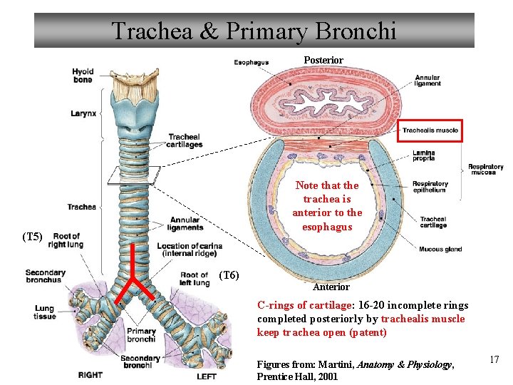 Trachea & Primary Bronchi Posterior Note that the trachea is anterior to the esophagus