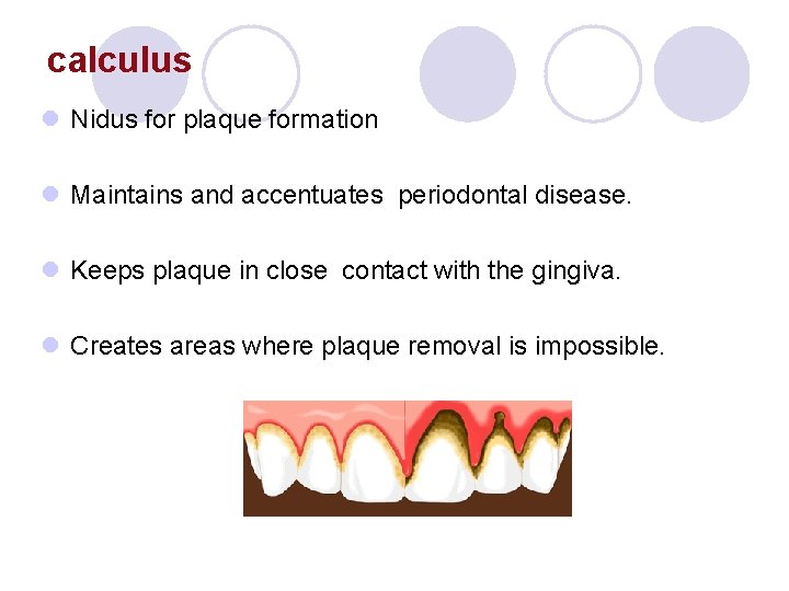 calculus l Nidus for plaque formation l Maintains and accentuates periodontal disease. l Keeps calculus l Nidus for plaque formation l Maintains and accentuates periodontal disease. l Keeps