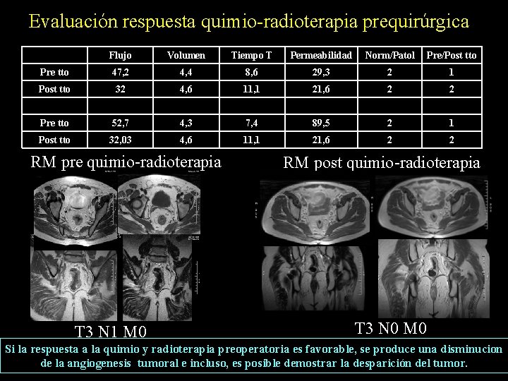 Evaluación respuesta quimio-radioterapia prequirúrgica Flujo Volumen Tiempo T Permeabilidad Norm/Patol Pre/Post tto Pre tto