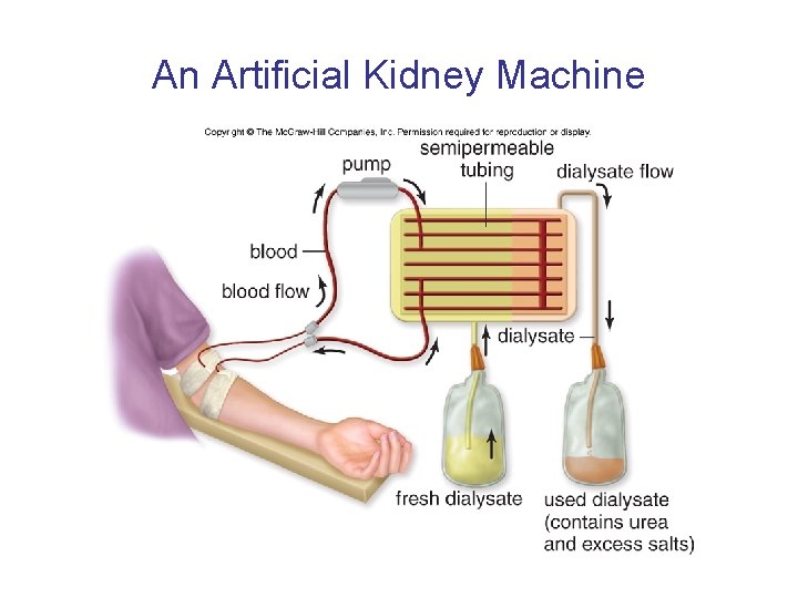 An Artificial Kidney Machine 