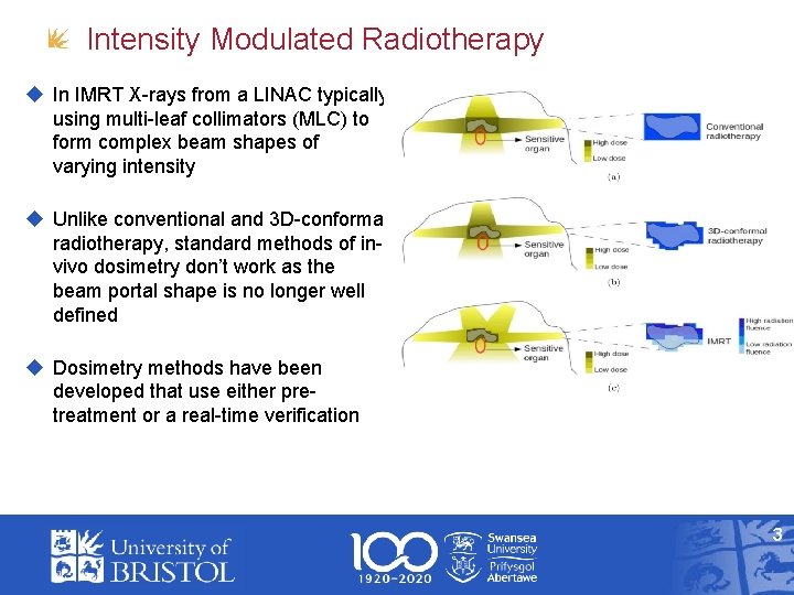 Intensity Modulated Radiotherapy In IMRT X-rays from a LINAC typically using multi-leaf collimators (MLC)