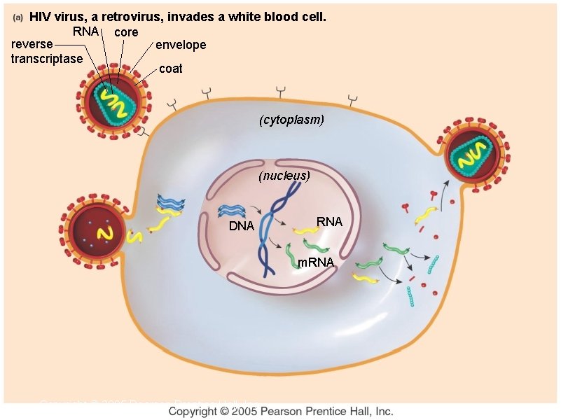 HIV virus, a retrovirus, invades a white blood cell. RNA core reverse envelope transcriptase