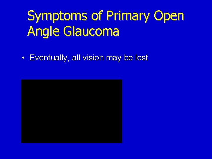 Symptoms of Primary Open Angle Glaucoma • Eventually, all vision may be lost 