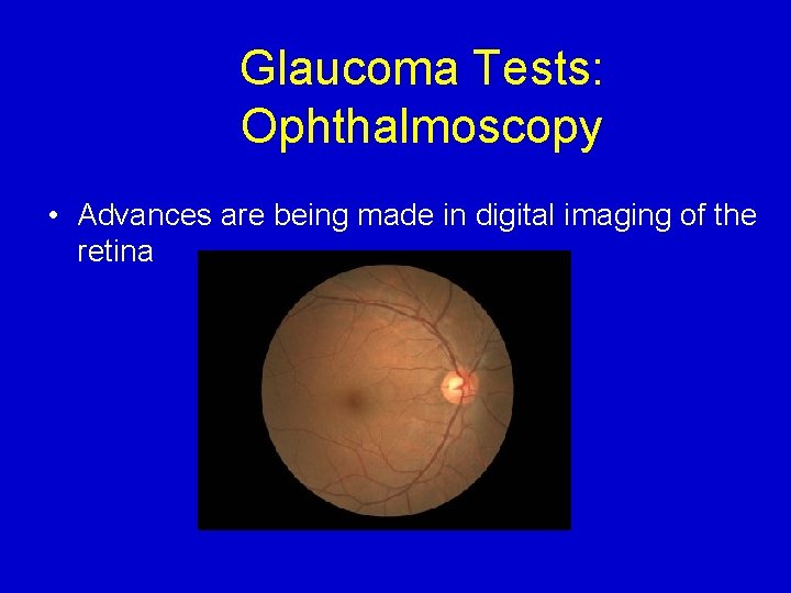 Glaucoma Tests: Ophthalmoscopy • Advances are being made in digital imaging of the retina