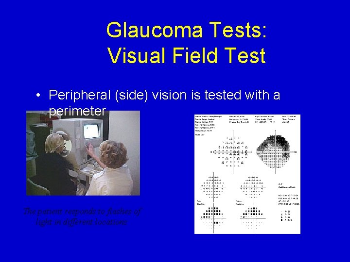 Glaucoma Tests: Visual Field Test • Peripheral (side) vision is tested with a perimeter