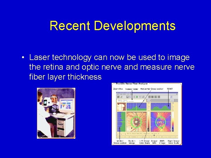 Recent Developments • Laser technology can now be used to image the retina and